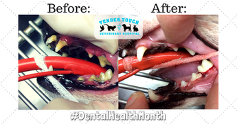Dental Cleaning Before & After